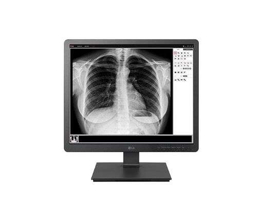 19 inch 1.3mp clinical review monitor