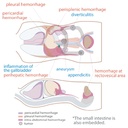 FAST/Acute Abdomen Phantom "FAST/ER FAN"