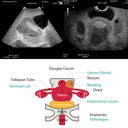 Female Pelvic Ultrasound Phantom - Gynae