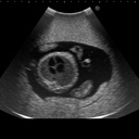 Fetus Ultrasound Examination Phantom 
"SPACE FAN-ST"