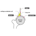 Infant Hip Sonography Training Phantom