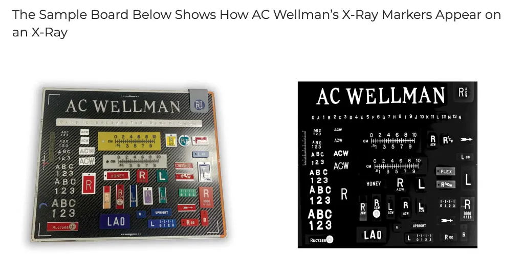 How markers appear on x-ray.webp