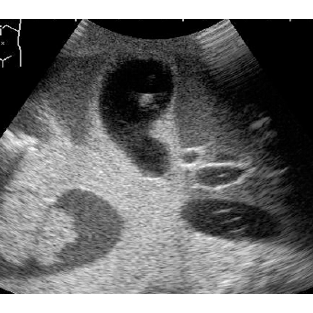 Ultrasound Examination Training Phantom "ABDFAN"