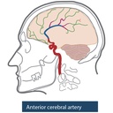 Angiographic CT Head Phantom ACS