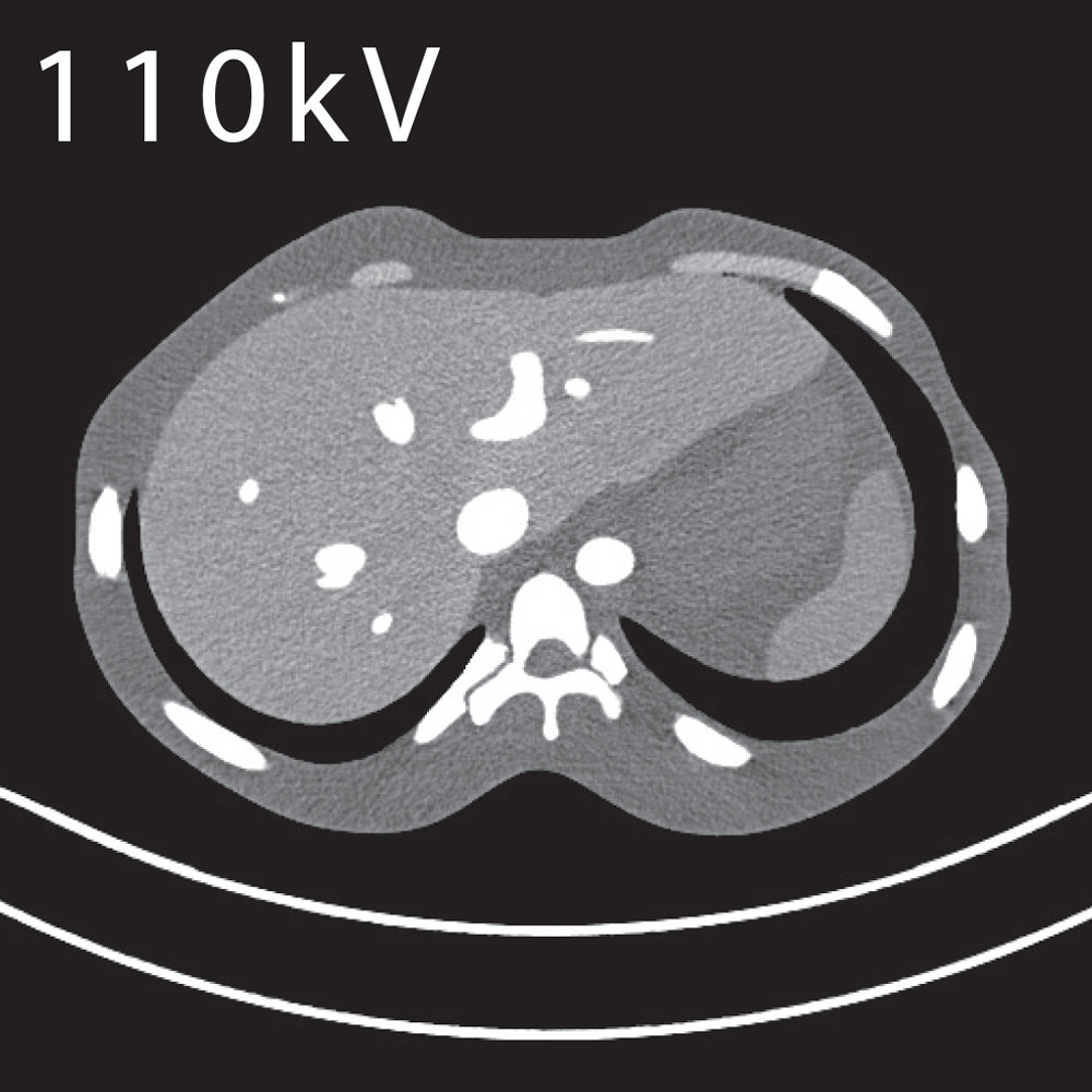 CT Abdomen Phantom