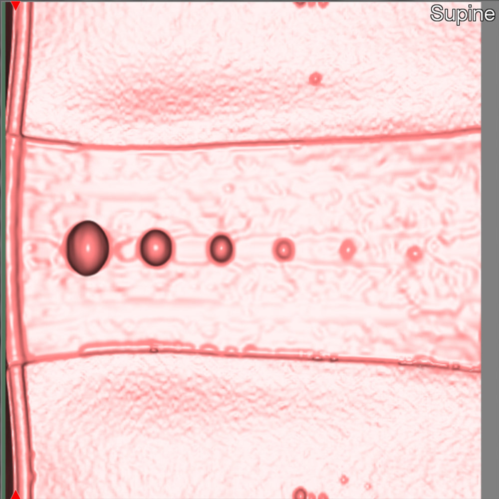 CT Colonography Phantom NCCS