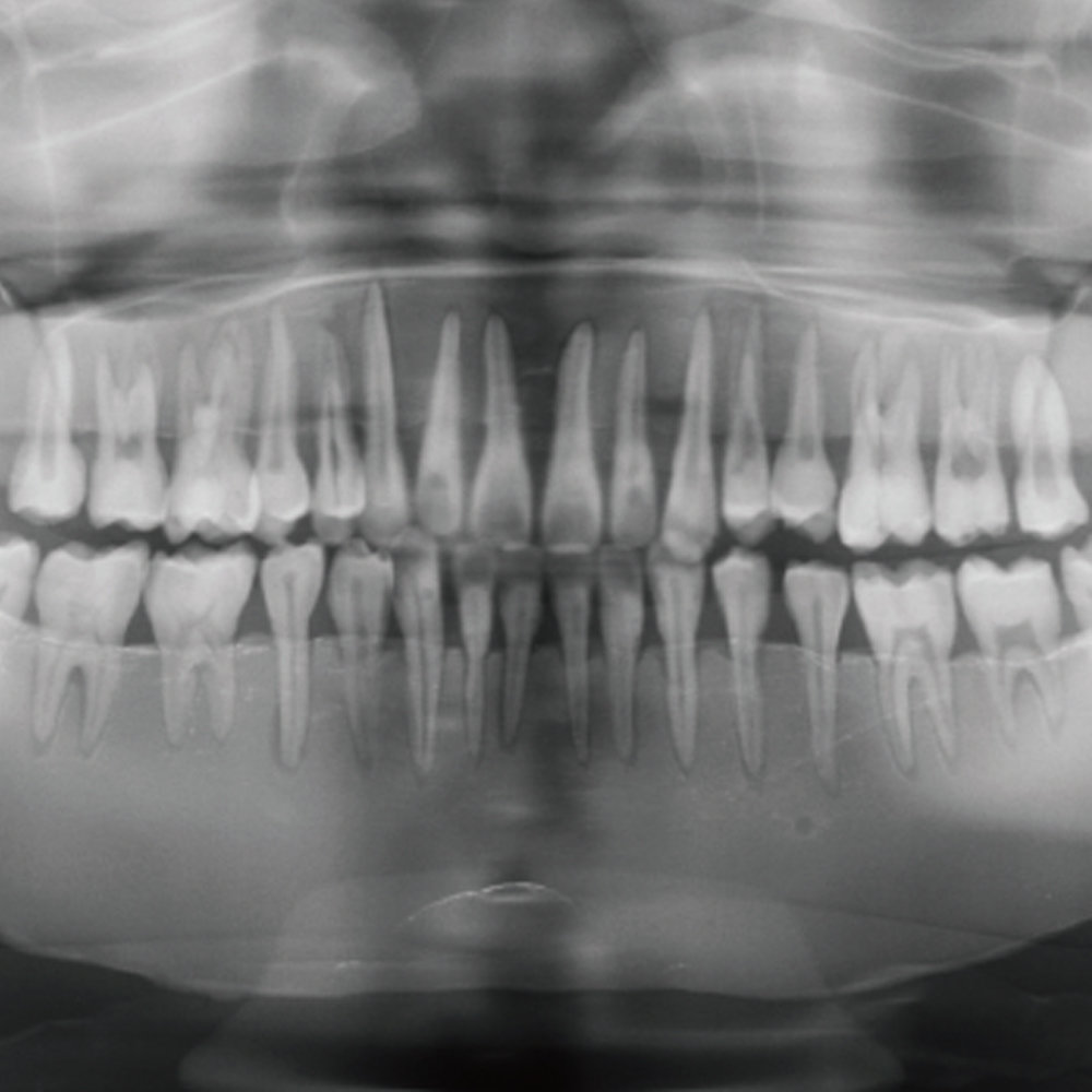 Dental Radiography Head Phantom
