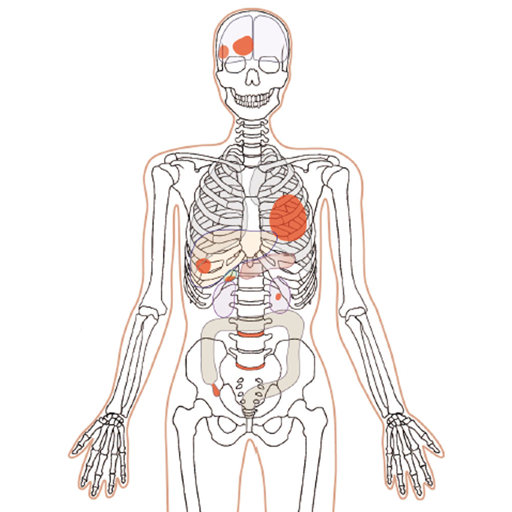 CT Whole Body Phantom "PBU-60"