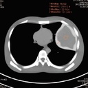 CT Whole Body Phantom - With Pathologies
